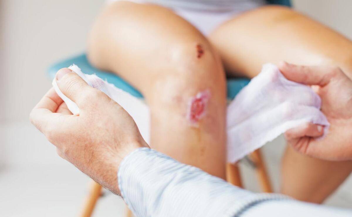 别把艾滋病错当皮肤病,身体出现3种情况,警惕艾滋病找上_消息_疾病