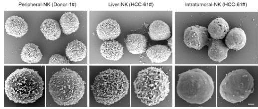 nature子刊:中国科学技术大学发现nk细胞失去抗癌功能
