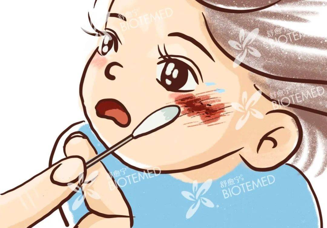 预防疤痕期■ 舒愈宁医用生物胶具有预防和淡化疤痕增生作用,伤口愈合