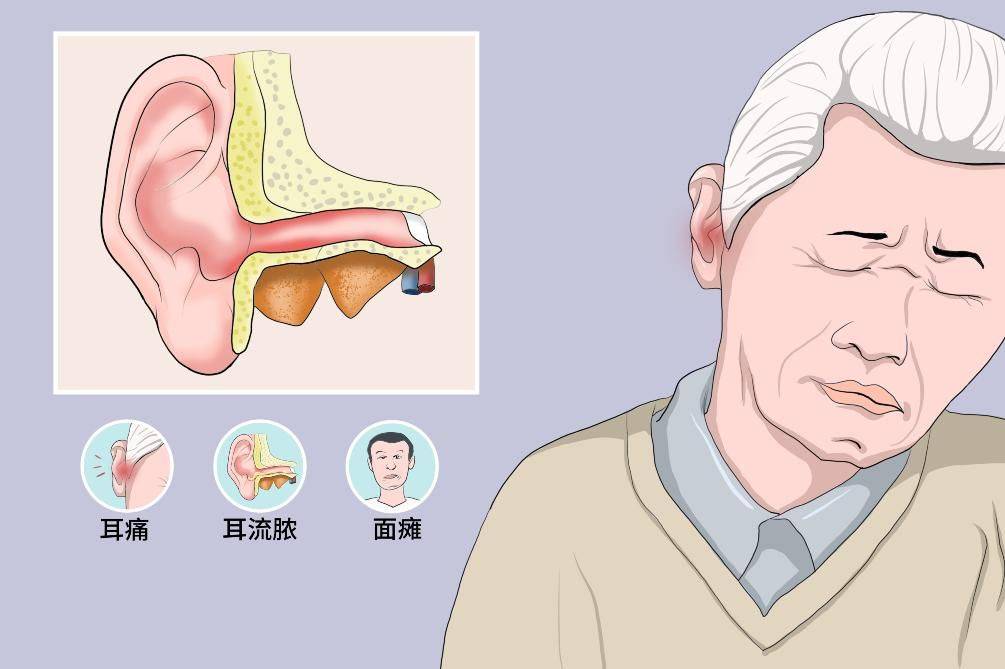 外耳道_患者_炎症