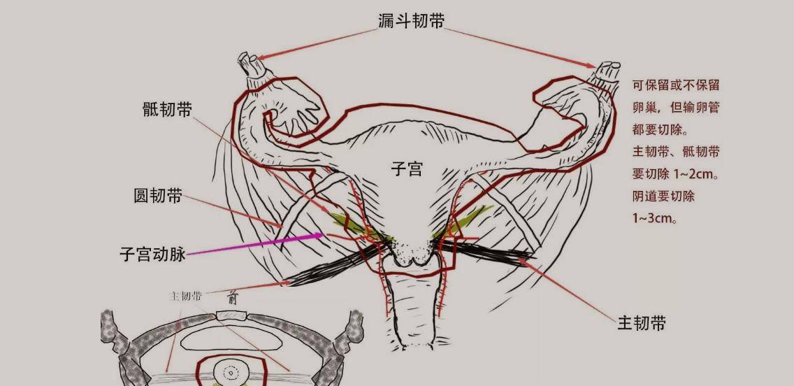 醫生不再隱瞞:沒了子宮的女性,身體將承受5大難言之隱!心疼!