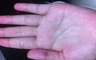 想排毒,只需要简单六招_肝脏_身体_功能