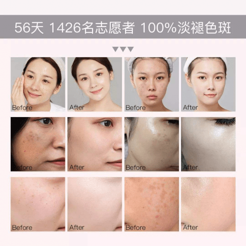 淡斑紧致抗皱的护肤品，哪款最值得入手？-淡斑抗皱的用什么好