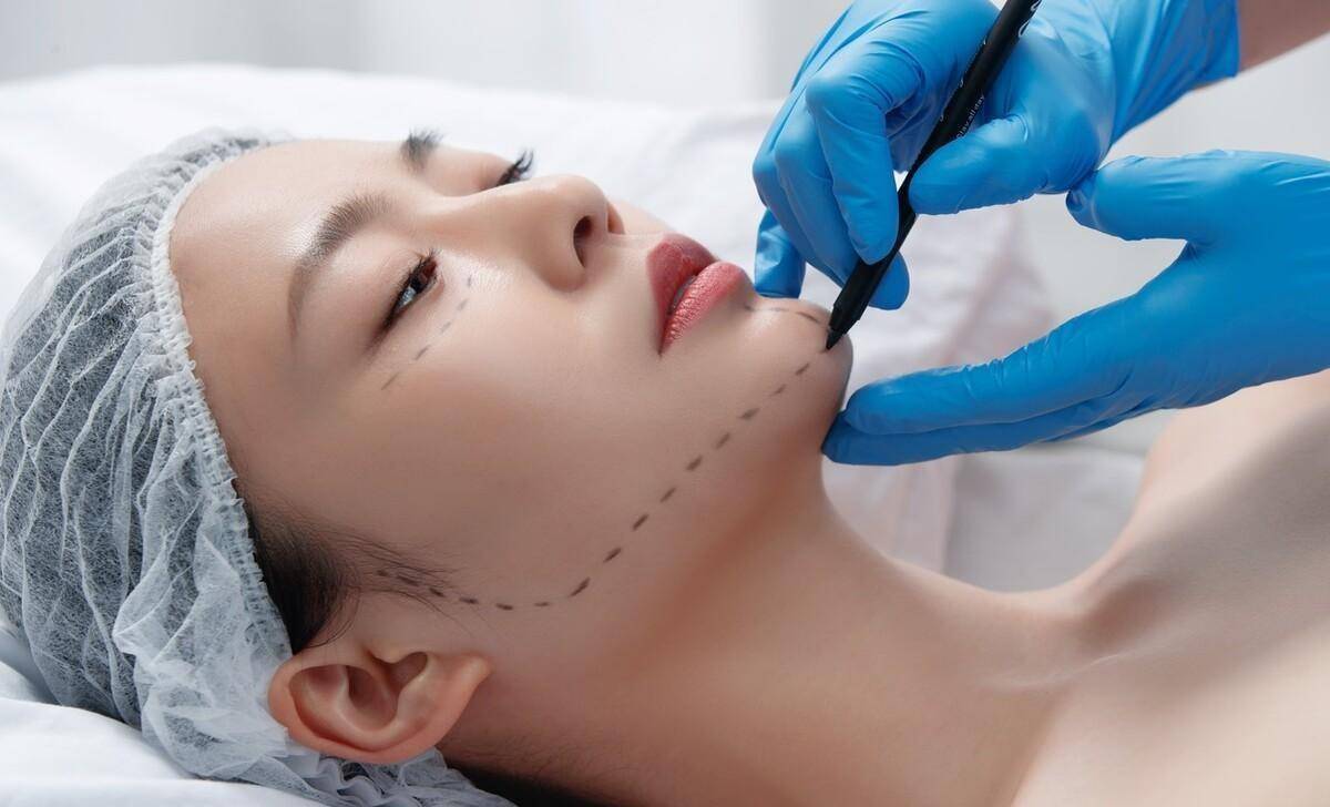 筋膜悬吊面部提升术保持多久、过来人讲述讲筋膜悬吊能维持多久~-面部筋膜悬吊术手术过程是怎样做的
