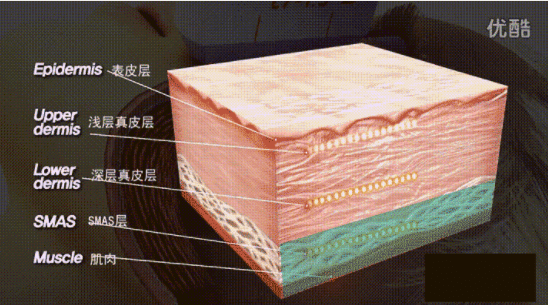 实话实说：超声炮有副作用吗？超声炮的副作用和危害！-一台超声炮价格
