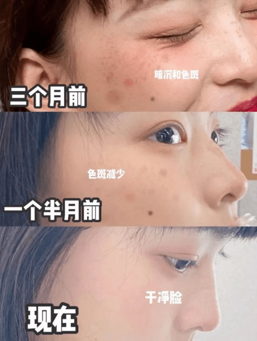 淡斑紧致抗皱的护肤品，国货第一款好用！（抗皱淡斑精华液排行榜）