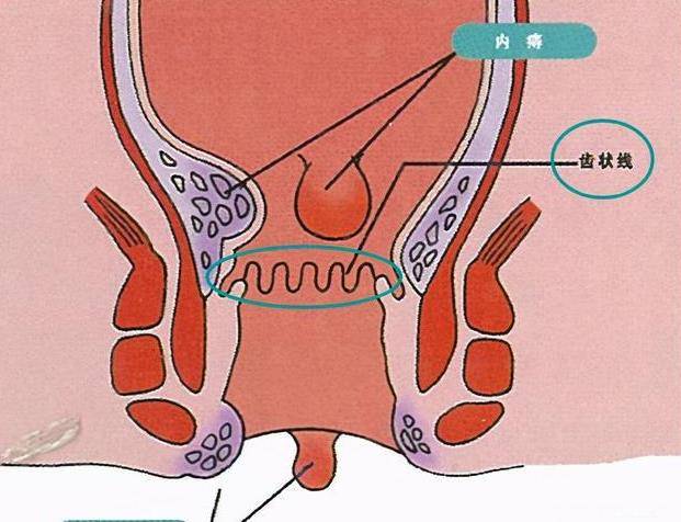 肛门正常是什么样的图片