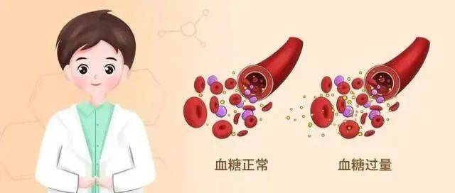 出现这4种情况,一定要警惕血糖是否异常!