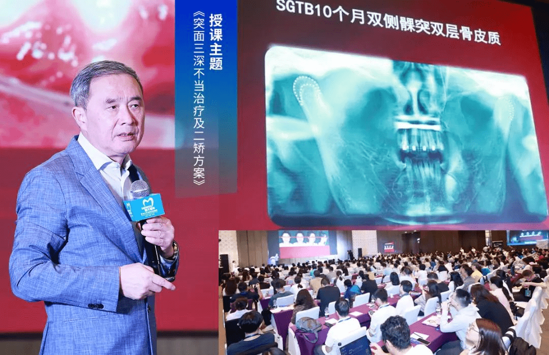 全国500位口腔同道齐聚羊城,共探ii类错合畸形矫治学