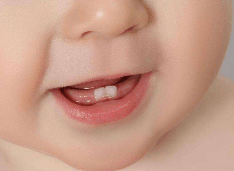 婴儿牙床正常图白色图片
