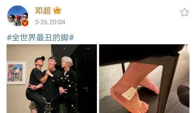 邓超鹿晗看望术后的陈赫,调侃他的脚全世界最丑,三人合影搞怪_绷带