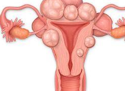 女人自查:身体出现这4个症状,可能得了子宫颈肥大_诊断_检查_鉴别