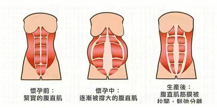 产后身材被吐槽!如何实现产后身材自由?