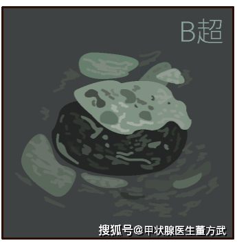 甲状腺结节健康科普（甲状腺结节的健康指导内容）