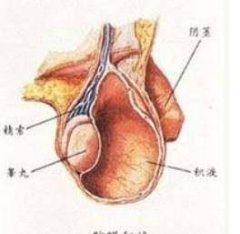 蛋蛋一大一小,怎么回事?_肿块_积液_治疗