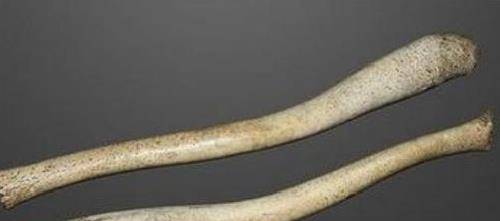 人类为何会失去"丁丁骨",这是身体哪个部位?是进化还是退化?