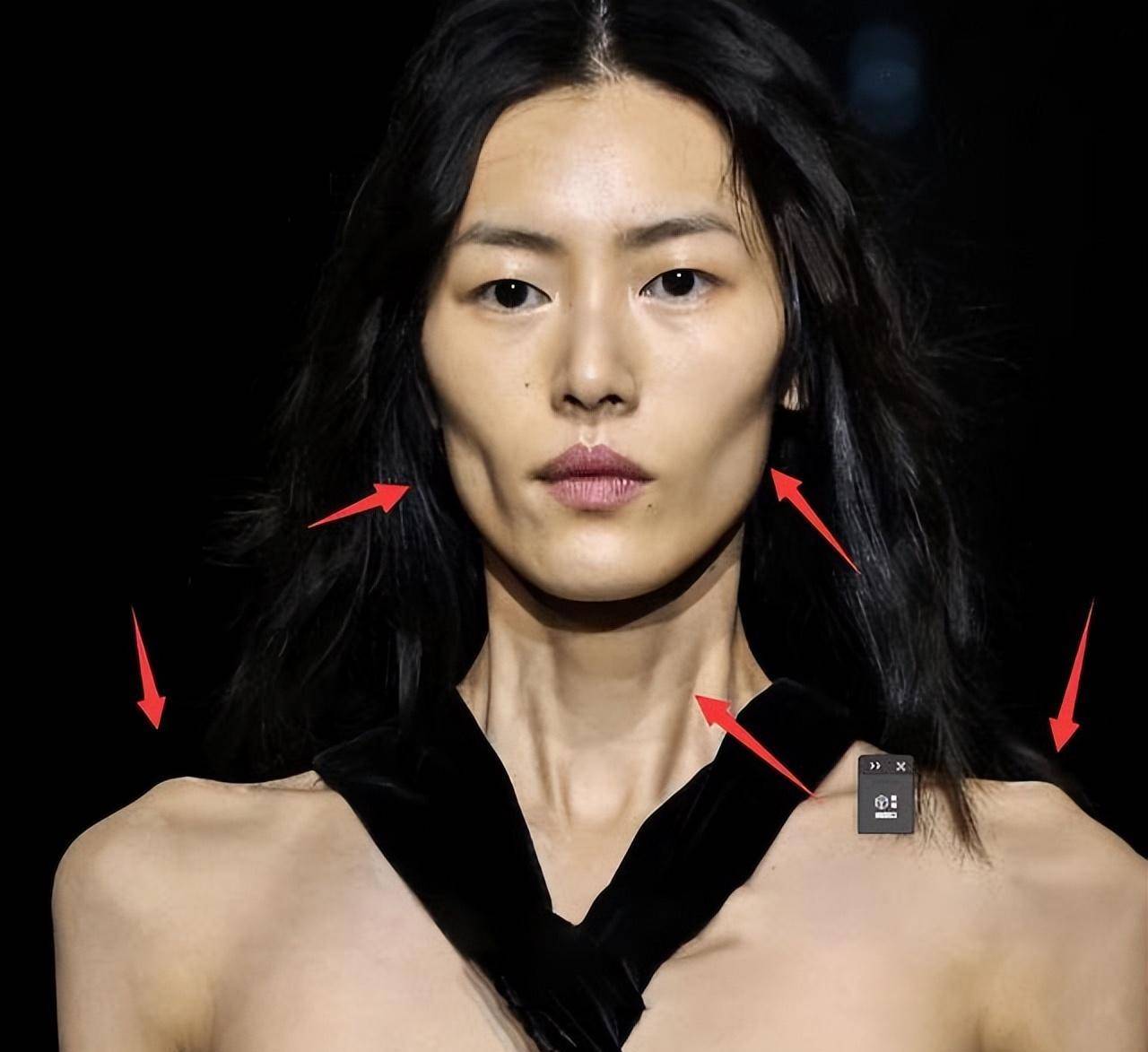 刘雯脸部凹陷,颈部的线条也非常清晰可见,肩骨突出,骨头清晰可见.