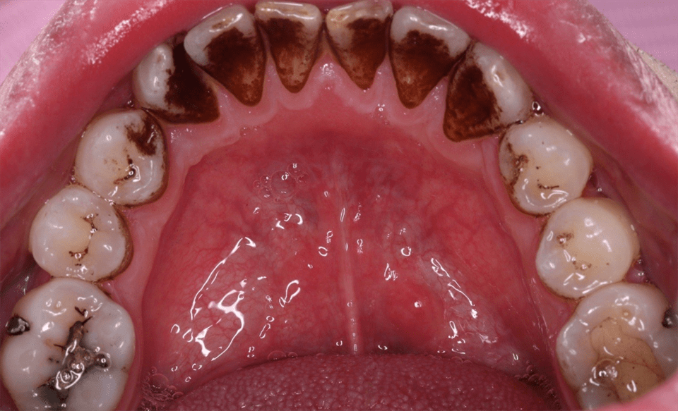 牙粉_牙齿_牙膏