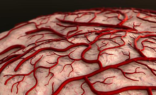 提醒:身体出现4个信号,小心脑动脉硬化,莫忽视!_血管_问题_情况