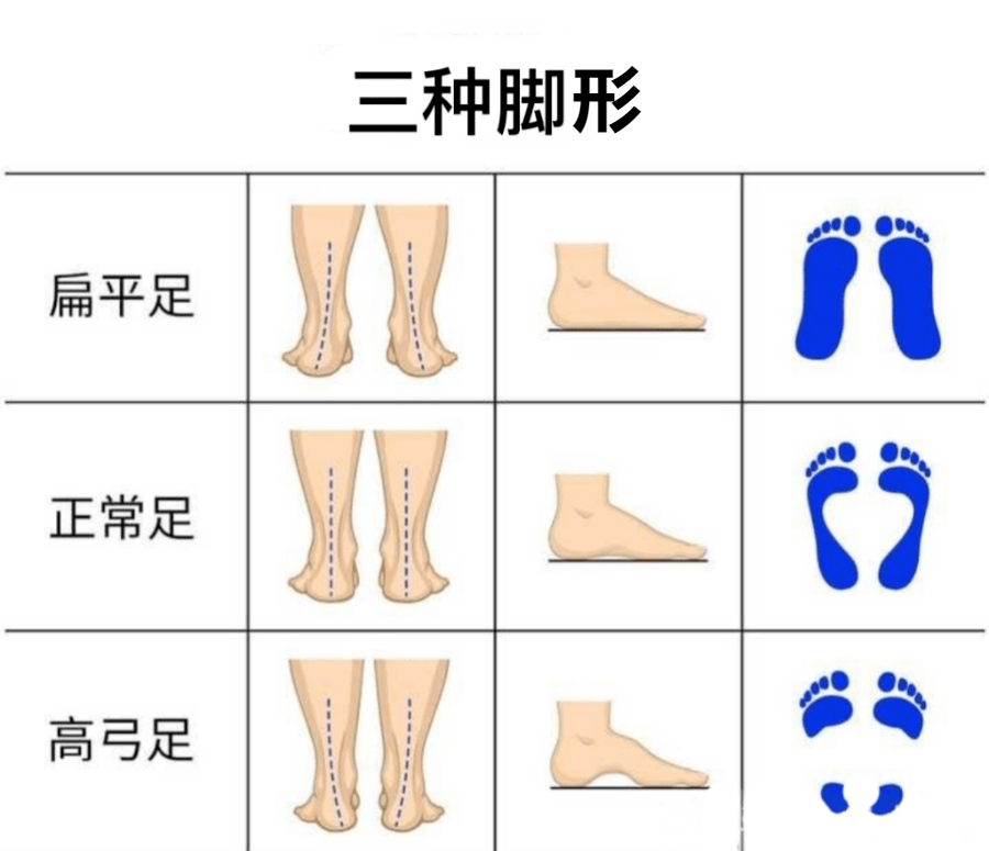 怎样测量跟腱长度图解图片