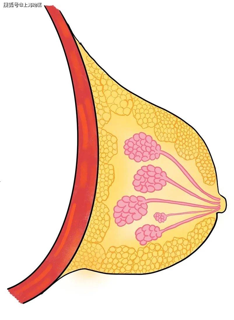 当你有乳腺结节了,距离乳腺癌有多远?_女性_肿块_乳头