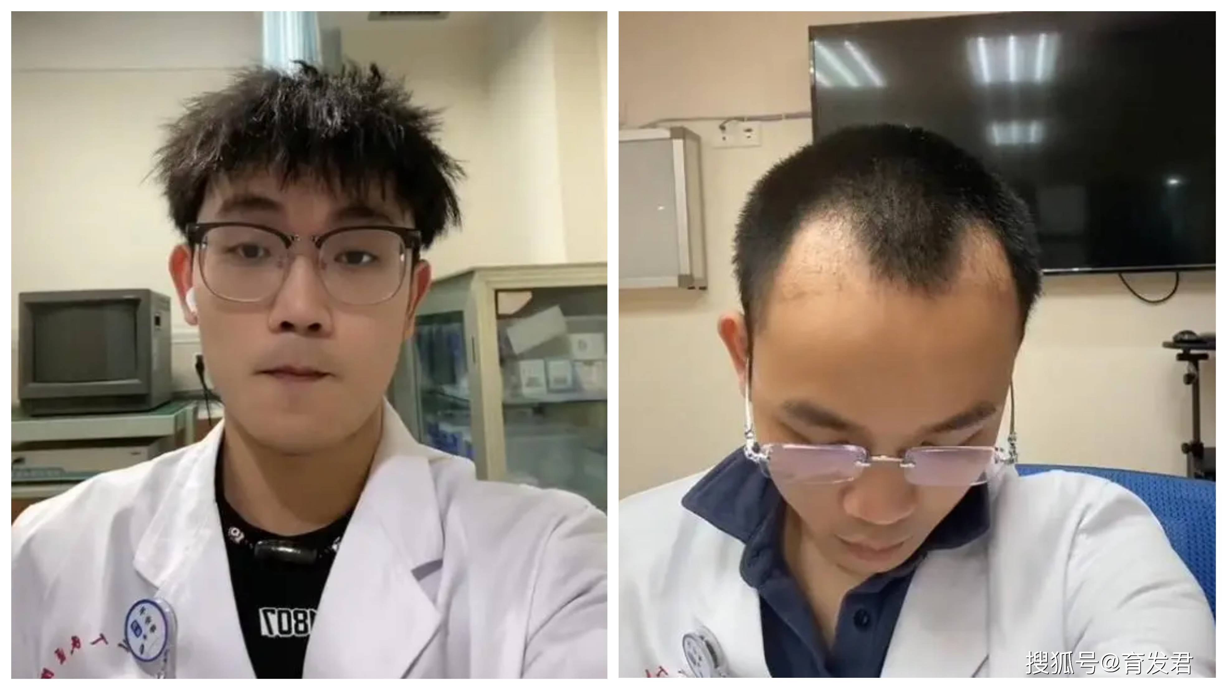 嘤嘤嘤,医生也是脱发受害者