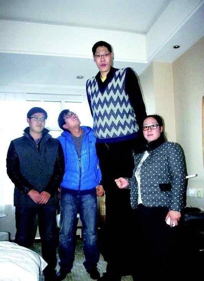 亚洲第一巨人张俊才:身高竟达2.42米,斩获世界纪录后生活如何?