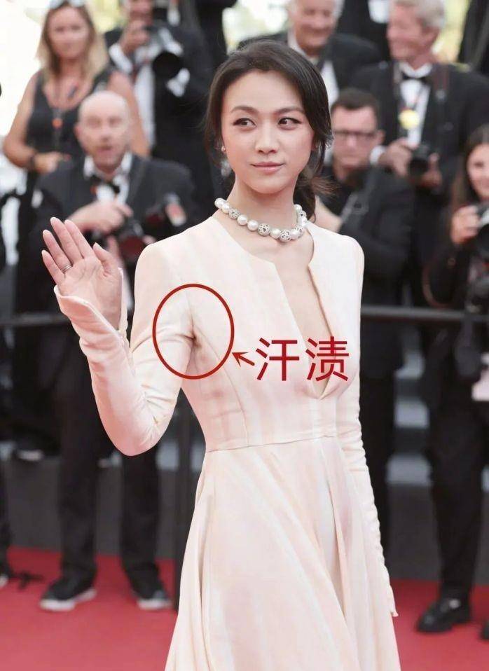 女明星也有腋窝无光泽的问题?