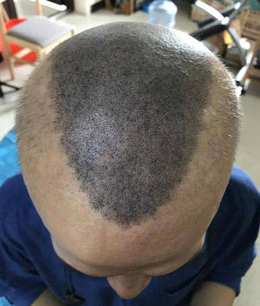 纹发效果好不好?_机构_专业_权益