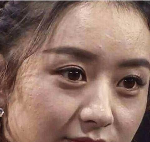 女星未ps照片流出,赵丽颖满脸疙瘩,杨颖面黄肌瘦,最美的你想不到_皮肤