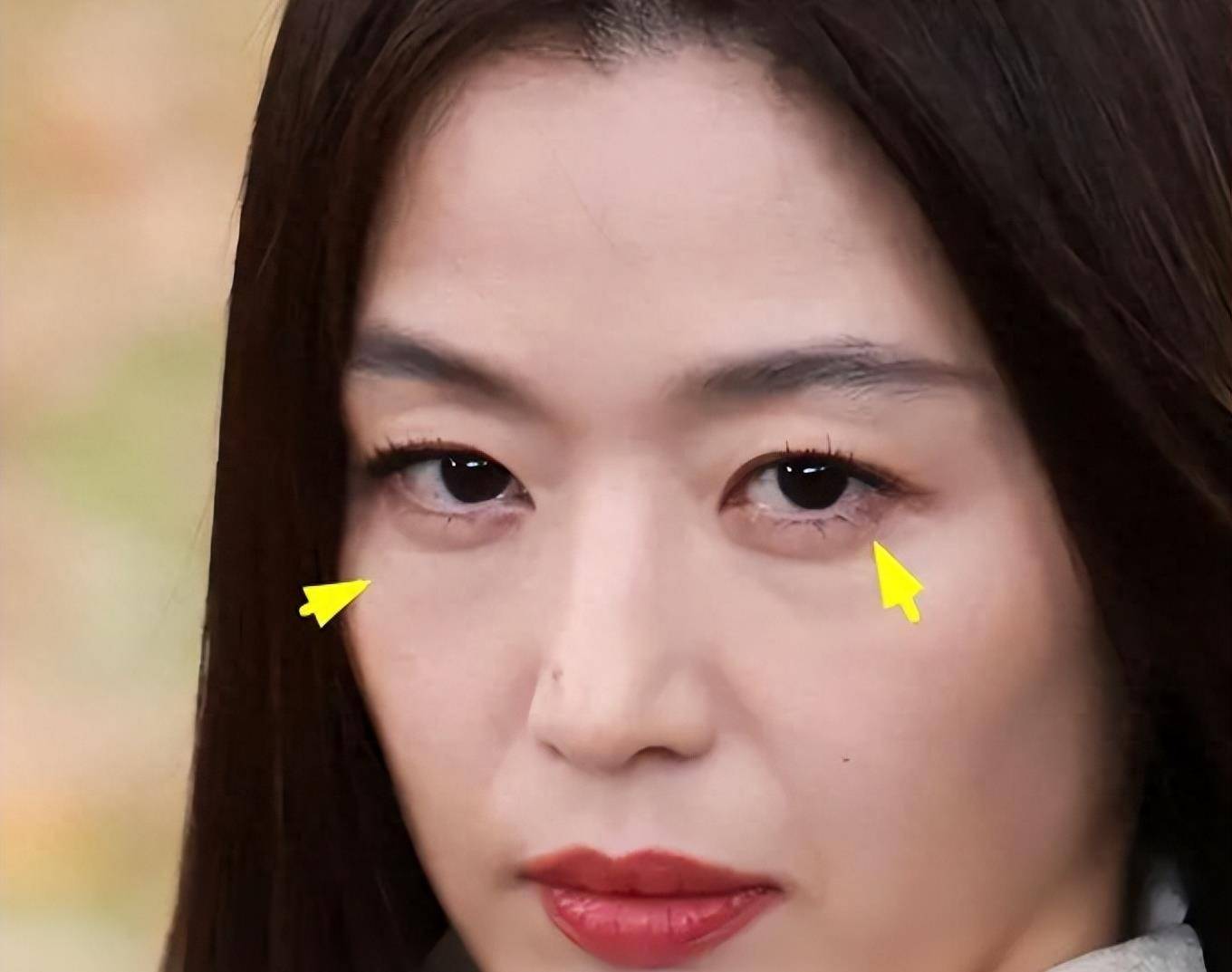 眼袋与皱纹齐飞变老阿姨,满是毛孔太尴尬_因为_明星