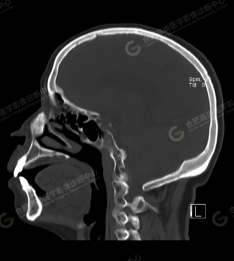 384081cd7dca4962ae4e4b0a5af2e63a