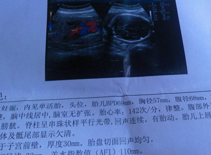 孕检报告单怀孕图片
