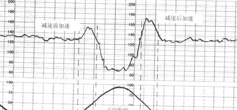 b超单上的这3个数据,或许暗示你"小王子"在腹中,快来自测一下_宝宝