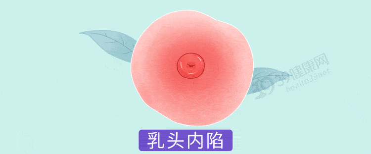 乳房酒窝是什么样子图片