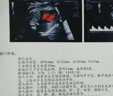 孕期檢查,孕媽若看懂b超上這4個數據,胎兒或許就沒什麼小秘密了_寶寶