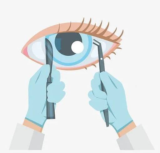 你真的了解近视手术吗?你想的太简单了!_角膜_视网膜_晶状体