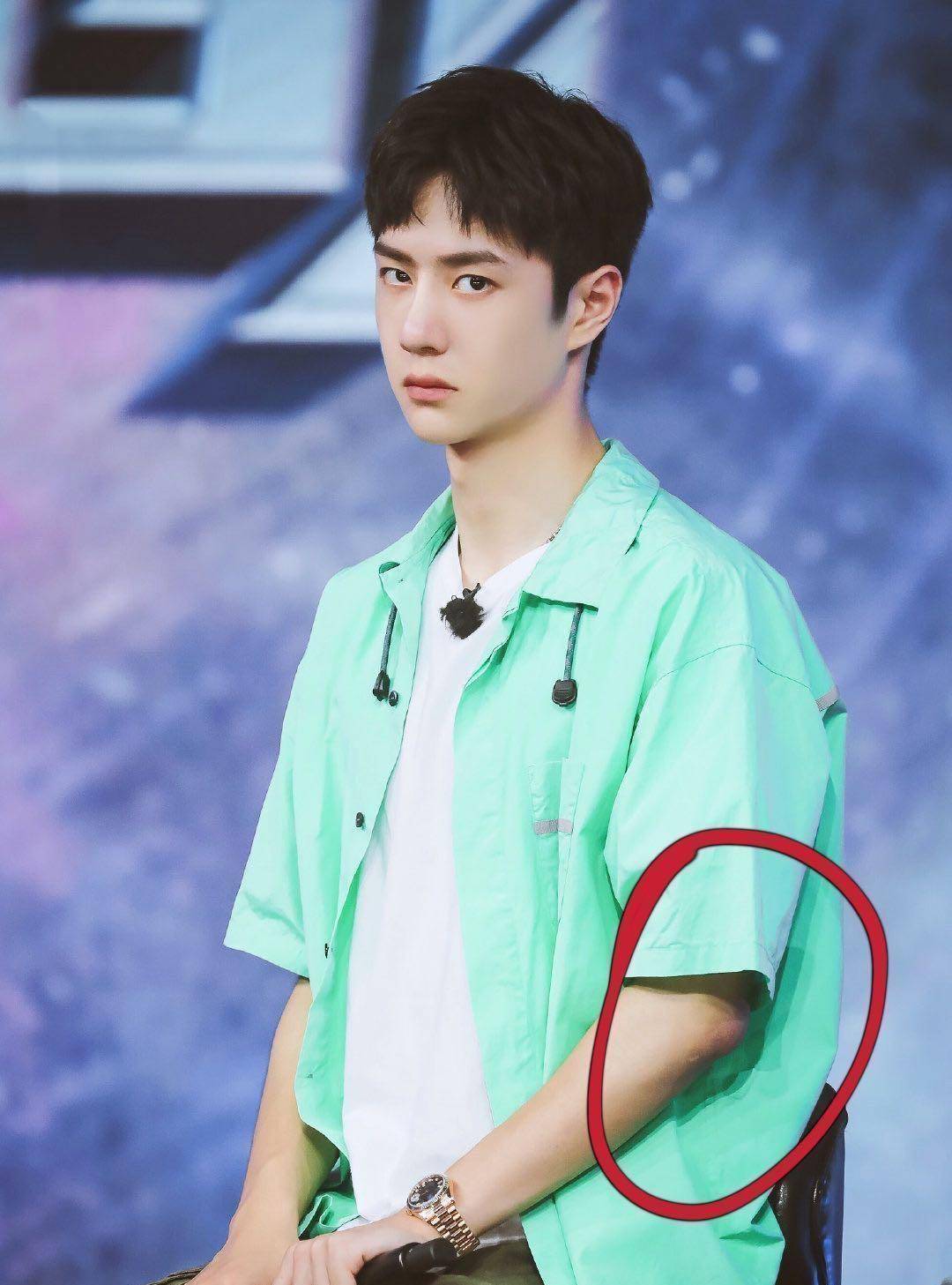 王一博最新《天天》胳膊肿了!