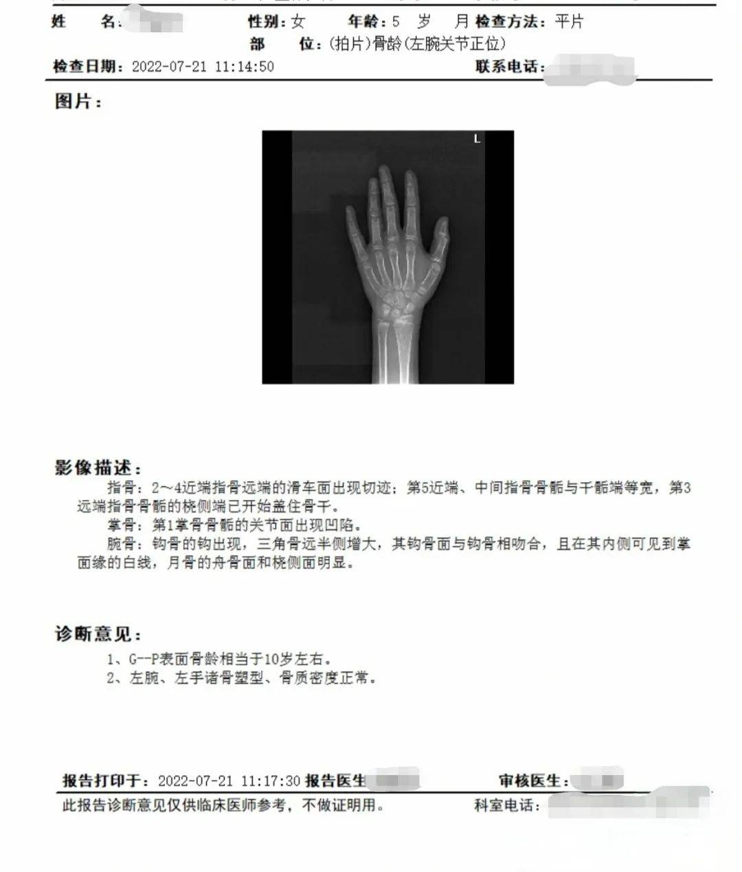 常见骨龄标准哪种更适合我国孩子?