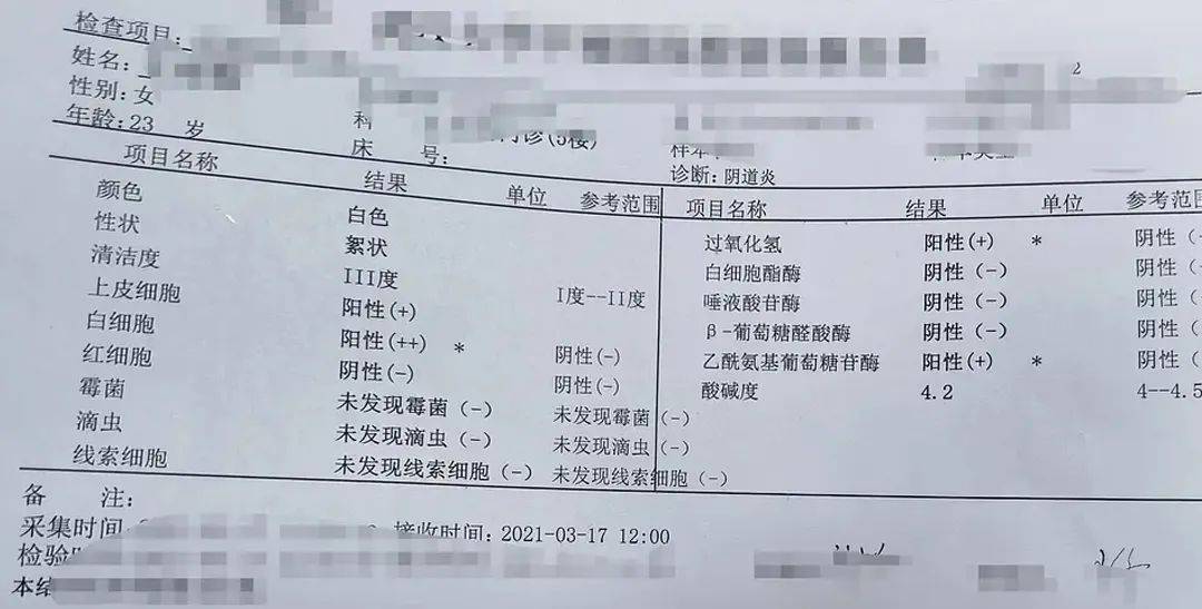 女性如何通过白带辨别是否健康