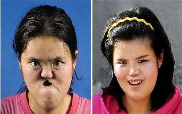 1988年,陕西农民捡到面部畸形女婴,整容变美后嫁给了农民儿子_王友仁