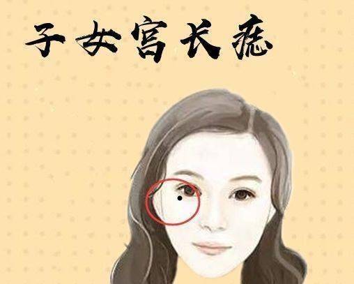 女人左眼睫毛根部长痣图片