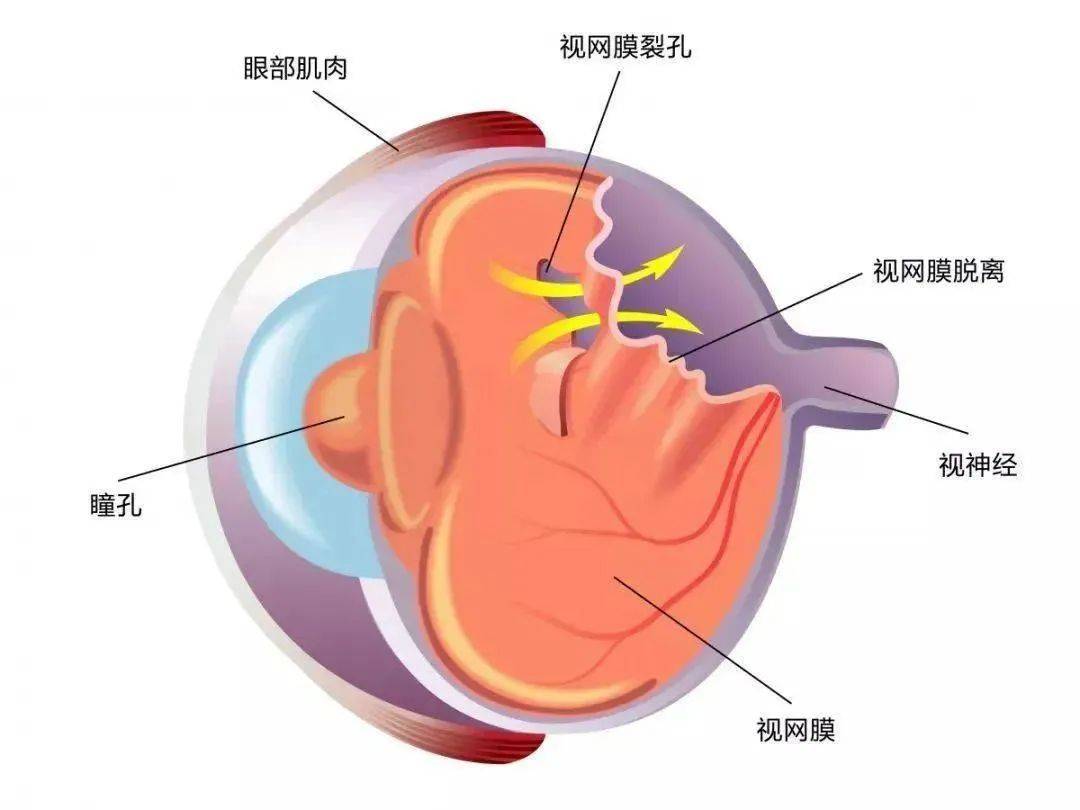 巩膜的位置图片