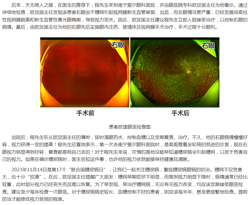 近视眼镜框品牌排行_推荐几个眼镜框架品牌(2)