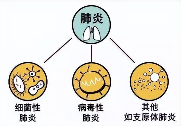 冬季肺炎高发,这些事情请注意!_症状_患者_疾病