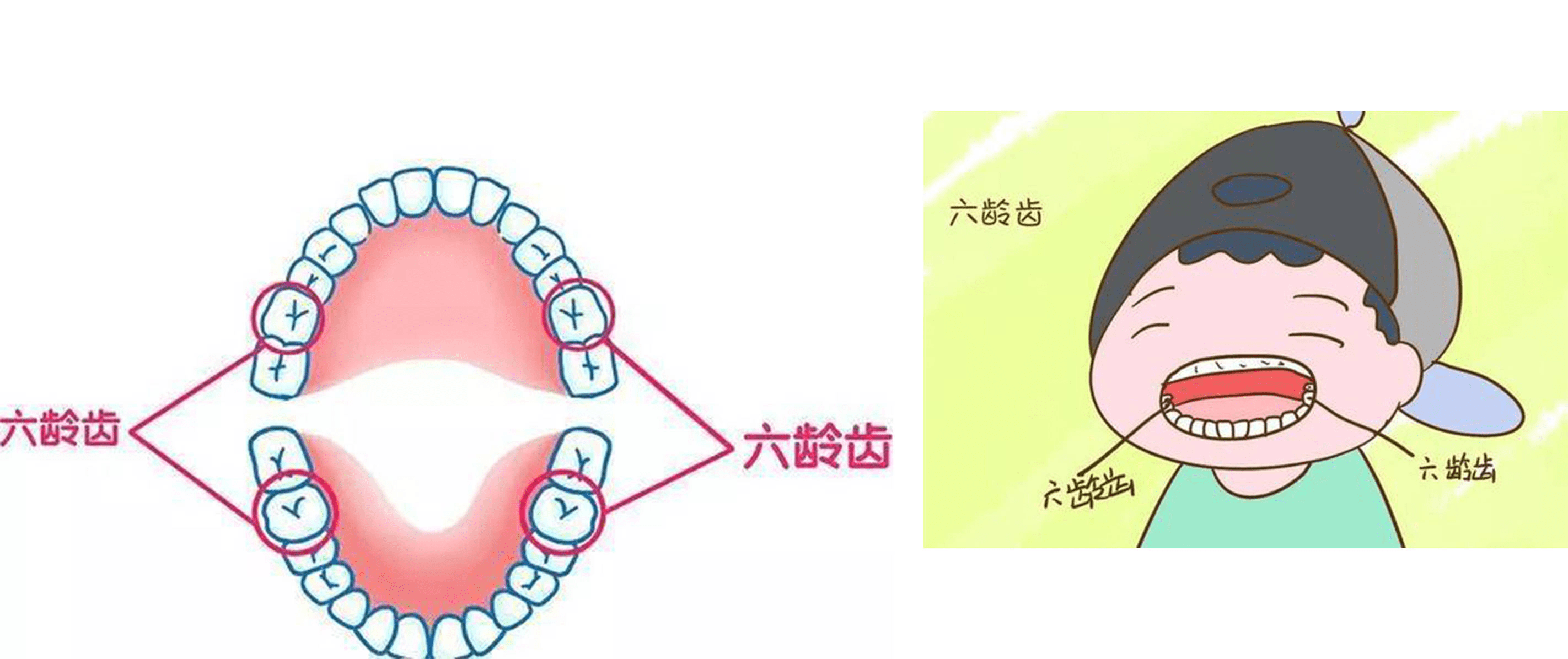 六龄牙有几颗图片