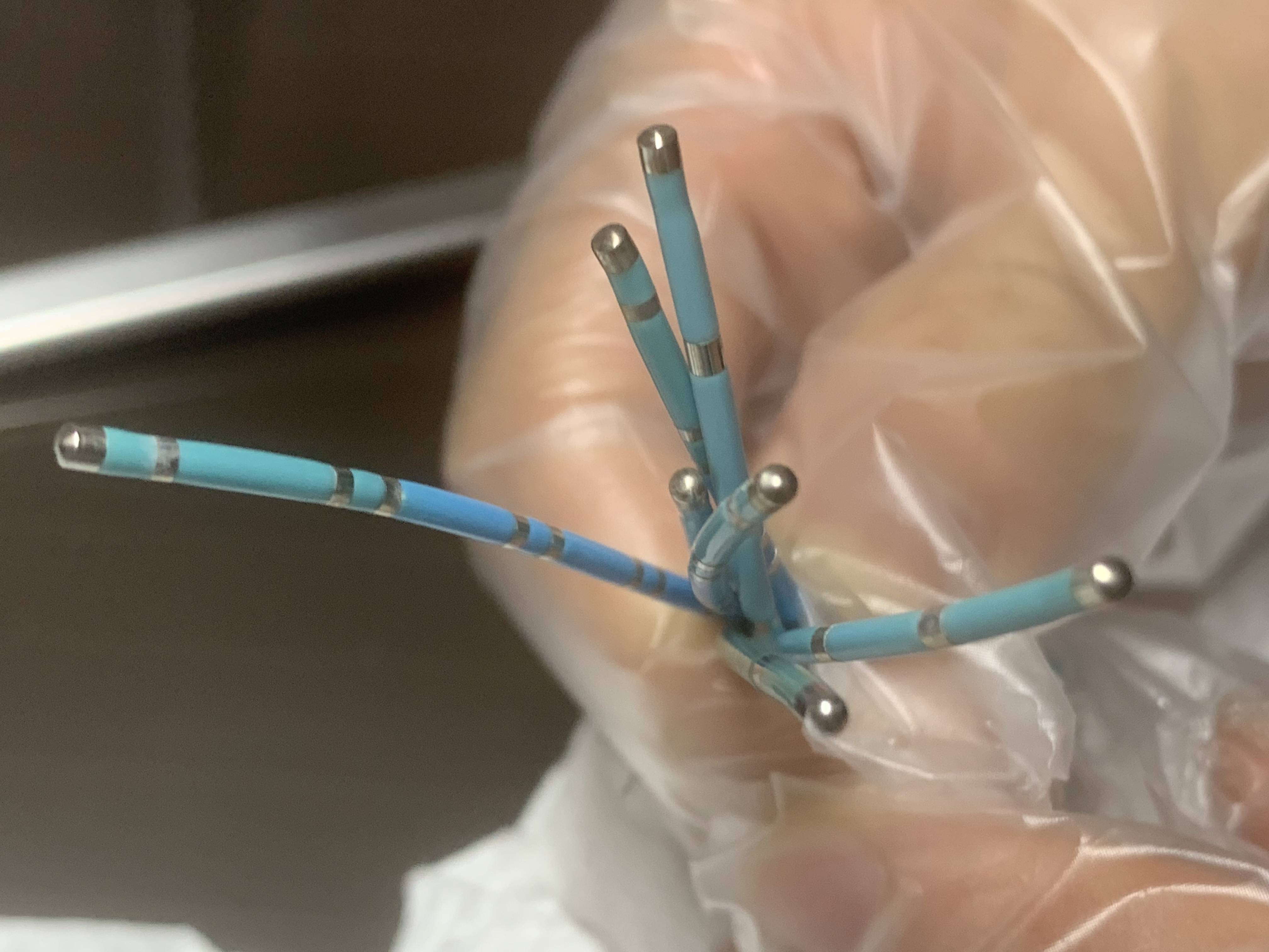 射频消融电生理导管回收_过程_处理_进行