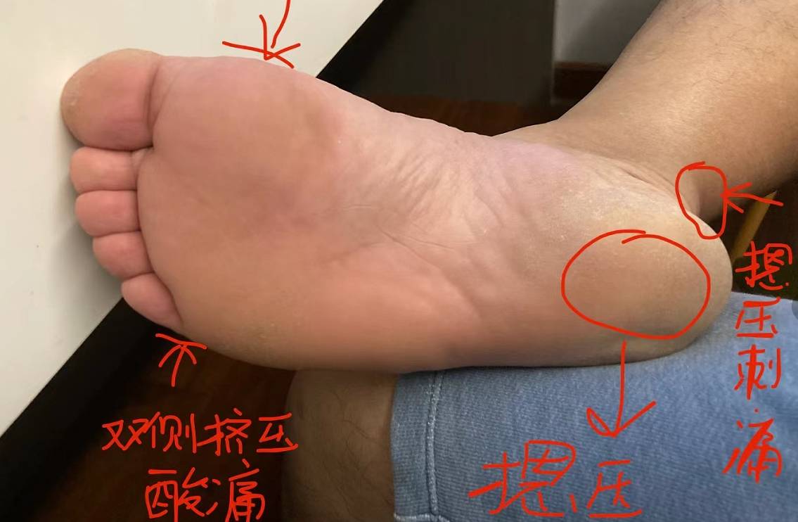 后面我虽然也服用了不少的口服药,甚至是偏方,可是都没有任何效果,还