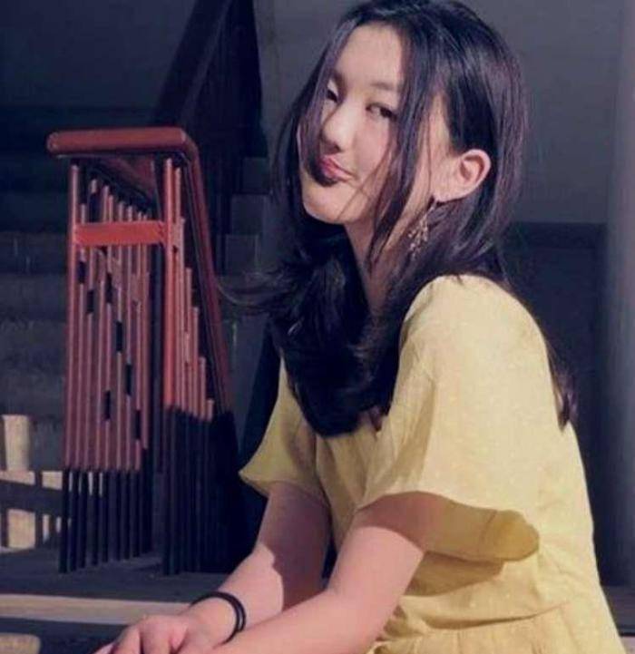 我们看到李嫣就是一位"兔唇"患者,通过多次整容和矫正手术成功摆脱了