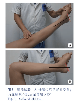 北京大榮診所胡霞:兒童高弓足畸形的臨床評估方法_患兒_檢查_下關